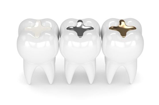 Dental Shape Bremen Inlays